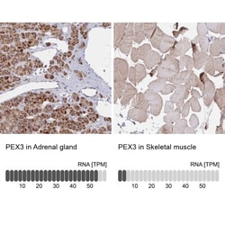 PEX3 Antibody, Novus Biologicals 25 &mu;L, Unlabeled:Antibodies, Polyclonal